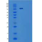 小鼠血管细胞粘附1（Vascular cell adhesion 1）重组蛋白