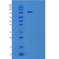小鼠血管细胞粘附1（Vascular cell adhesion 1）重组蛋白