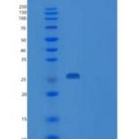 人VPS24重组蛋白