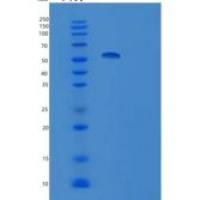 人泛素特异性肽酶14(USP14)重组蛋白