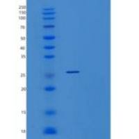 人YAE1D1重组蛋白