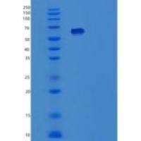人酪氨酰tRNA合成酶(YARS)重组蛋白
