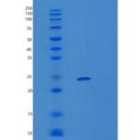 人VPS28重组蛋白