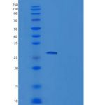 人泛素特异性肽酶15(USP15)重组蛋白