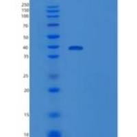 人无翅型MMTV整合位点家族成员7A(WNT7A)重组蛋白