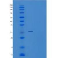 人AN1-型锌指域蛋白3(ZFAND3)重组蛋白