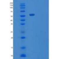 人Visfatin重组蛋白