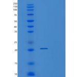 人VSTM2L重组蛋白