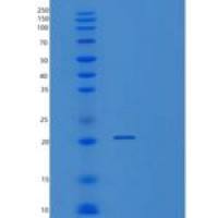 人VSTM2L重组蛋白