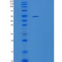 人泛素结合酶E2 H重组蛋白