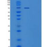 人ZWILCH重组蛋白
