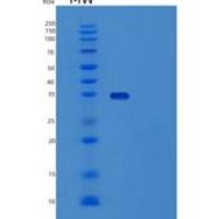 人X-射线修复交叉互补蛋白2(XRCC2)重组蛋白