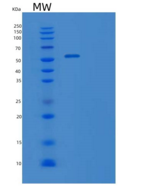 人牛痘相关激酶3(VRK3)重组蛋白