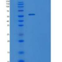 人牛痘相关激酶3(VRK3)重组蛋白