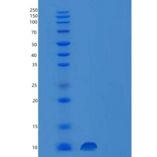 人囊泡关联膜蛋白8(VAMP8)重组蛋白