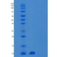 人囊泡关联膜蛋白8(VAMP8)重组蛋白