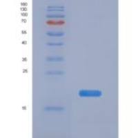 人玻连蛋白(VTN)重组蛋白