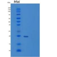 人YIF1B重组蛋白