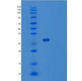 人囊泡关联膜蛋白关联蛋白B(VAPB)重组蛋白