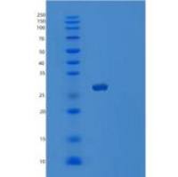 人囊泡关联膜蛋白关联蛋白B(VAPB)重组蛋白
