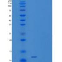 人VOPP1重组蛋白
