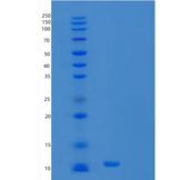 人细胞色素b-c1复合物亚单位8(UQCRQ)重组蛋白