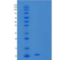 人细胞色素b-c1复合物亚单位8(UQCRQ)重组蛋白