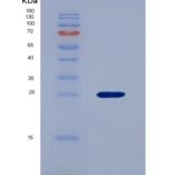 人血管内皮生长因子B(VEGFB)重组蛋白