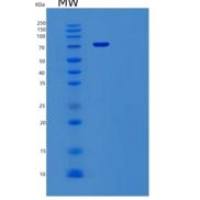 人血管细胞粘附分子1(VCAM1)重组蛋白