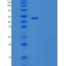 小鼠肝配蛋白-A1/EFNA1(C-Fc-6His)重组蛋白