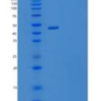 小鼠肝配蛋白-A1/EFNA1(C-Fc-6His)重组蛋白
