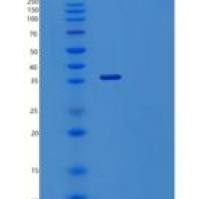 人自噬相关3同源物/ATG3(C-6His, N-T7 tag)重组蛋白