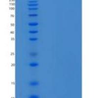 人胰岛素样生长因子ⅰ/IGFⅰ/胰岛素样生长因子1重组蛋白