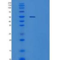 人ZNF514重组蛋白