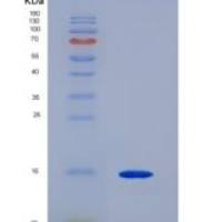 人囊泡关联膜蛋白4(VAMP4)重组蛋白