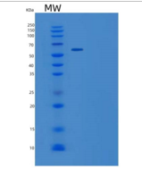 人WHSC2重组蛋白