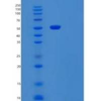 人泛醇细胞色素C还原酶核心蛋白Ⅰ(UQCRC1)重组蛋白
