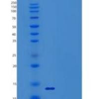 人小泛素相关修饰蛋白3/SUMO3/SMT3A蛋白（N-6His）重组蛋白