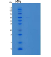 人酪氨酰tRNA合成酶2(YARS2)重组蛋白