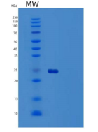 人泛素结合酶E2 T重组蛋白