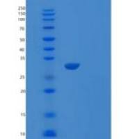 人囊泡关联膜蛋白关联蛋白A(VAPA)重组蛋白