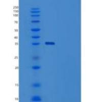 人ZNF346重组蛋白