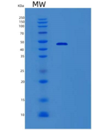 人Vav1癌基因(VAV1)重组蛋白