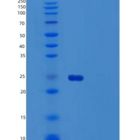 人泛素结合酶E2 T重组蛋白