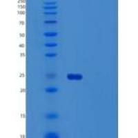 人泛素结合酶E2 T重组蛋白