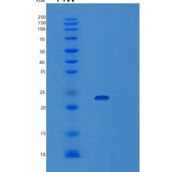 人VPS29 1-182aa重组蛋白