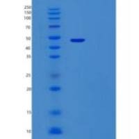 人内脏脂肪特异性丝氨酸蛋白酶抑制因子(Vaspin)重组蛋白