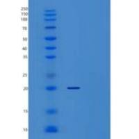 人α-晶体蛋白A链/晶体蛋白A(C-6His)重组蛋白