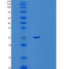 人组蛋白伴侣蛋白ASF1A/ASF1A(C-6His, N-T7 tag)重组蛋白