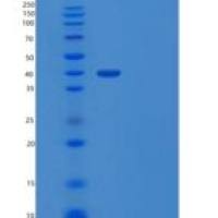 小鼠Wnt抑制因子1（Wnt inhibitory factor 1）重组蛋白